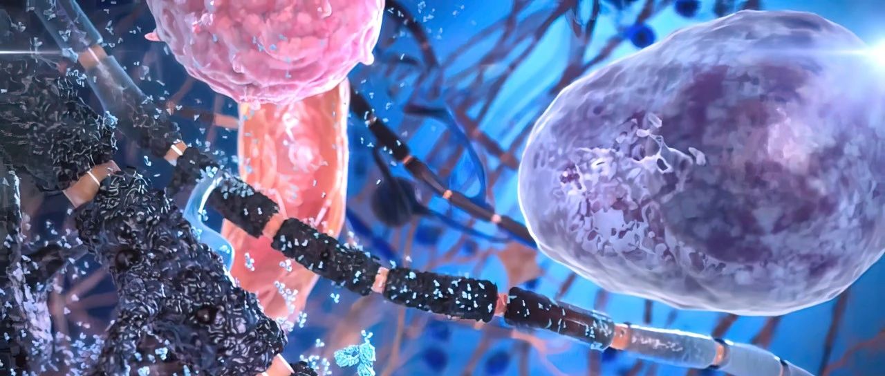 JCO重磅研究丨多发性骨髓瘤的基因组分类和个体化预后'