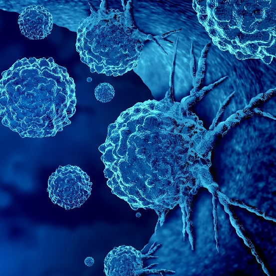 THE LANCET Haematology：平衡CAR-T细胞治疗的风险和益处'