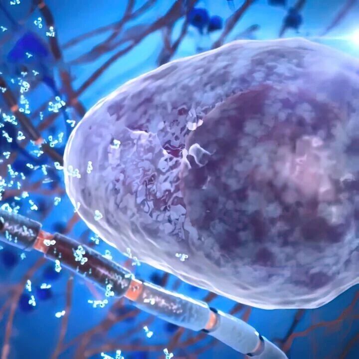 SCOPE-MM评分：预测复发/难治性多发性骨髓瘤患者BCMA CAR-T细胞治疗后疗效及毒性风险模型'